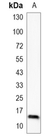 1 - Recombinant Anti-Histone H3 (Acetyl-K9) Rabbit mAb AP95225