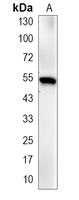 1 - Recombinant Anti-TrpRS Rabbit mAb AP95227