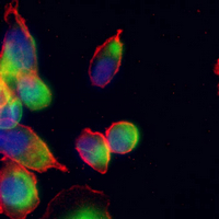 3 - Recombinant Anti-PLXNA1 Rabbit mAb AP95228
