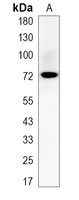 1 - Recombinant Anti-SLC22A1 Rabbit mAb AP95229
