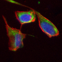 3 - Recombinant Anti-ROR2 Rabbit mAb AP95230