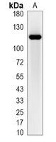 1 - Recombinant Anti-ROR2 Rabbit mAb AP95230