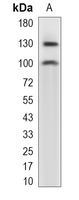 1 - Recombinant Anti-HIPK2 Rabbit mAb AP95232