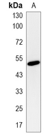 1 - Recombinant Anti-PICK1 Rabbit mAb AP95237