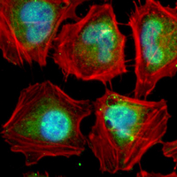 3 - Recombinant Anti-MAGEA1 Rabbit mAb AP95238