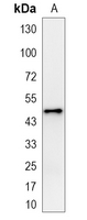 1 - Recombinant Anti-MAGEA1 Rabbit mAb AP95238