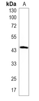 1 - Recombinant Anti-FRA2 Rabbit mAb AP95243