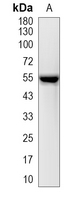 1 - Recombinant Anti-RAD23A Rabbit mAb AP95244