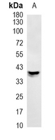 1 - Recombinant Anti-Galectin 8 Rabbit mAb AP95245