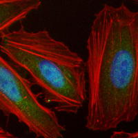 3 - Recombinant Anti-IKK epsilon Rabbit mAb AP95246
