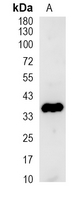 1 - Recombinant Anti-CRK Rabbit mAb AP95248
