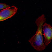 3 - Recombinant Anti-NPC1 Rabbit mAb AP95252