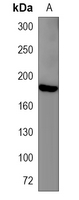 1 - Recombinant Anti-NPC1 Rabbit mAb AP95252