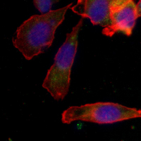 3 - Recombinant Anti-ABCD3 Rabbit mAb AP95256