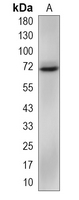1 - Recombinant Anti-ABCD3 Rabbit mAb AP95256