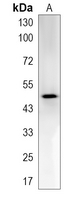 1 - Recombinant Anti-Pontin 52 Rabbit mAb AP95258