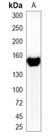 1 - Recombinant Anti-ADAMTS13 Rabbit mAb AP95260
