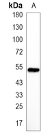 1 - Recombinant Anti-Cytochrome P450 1A2 Rabbit mAb AP95261