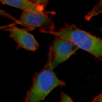 3 - Recombinant Anti-Cytochrome P450 17A1 Rabbit mAb AP95262