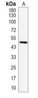 1 - Recombinant Anti-Cytochrome P450 17A1 Rabbit mAb AP95262