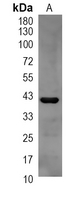 1 - Recombinant Anti-TMEFF2 Rabbit mAb AP95263