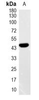 1 - Recombinant Anti-Renin Rabbit mAb AP95264