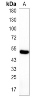 1 - Recombinant Anti-FKBP4 Rabbit mAb AP95267