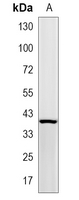 1 - Recombinant Anti-PTX3 Rabbit mAb AP95268