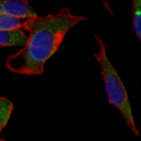 3 - Recombinant Anti-ATP7B Rabbit mAb AP95270