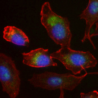 3 - Recombinant Anti-MetaP2 Rabbit mAb AP95272