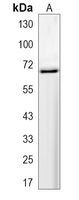 1 - Recombinant Anti-MetaP2 Rabbit mAb AP95272
