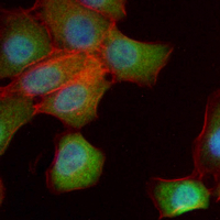 3 - Recombinant Anti-ADAR1 Rabbit mAb AP95274