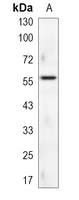 1 - Recombinant Anti-Monoamine Oxidase A Rabbit mAb AP95275