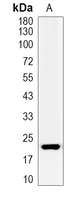 1 - Recombinant Anti-CD278 Rabbit mAb AP95276