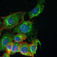3 - Recombinant Anti-PDLIM1 Rabbit mAb AP95278