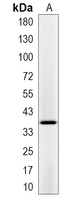1 - Recombinant Anti-PDLIM1 Rabbit mAb AP95278