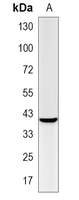1 - Recombinant Anti-BMP6 Rabbit mAb AP95279