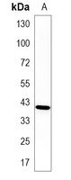 1 - Recombinant Anti-SSTR5 Rabbit mAb AP95280