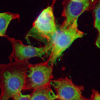 3 - Recombinant Anti-Cytochrome P450 2C9 Rabbit mAb AP95281