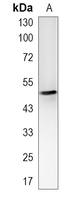 1 - Recombinant Anti-Cytochrome P450 2C9 Rabbit mAb AP95281