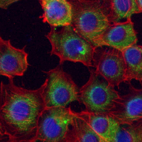 3 - Recombinant Anti-Ribophorin-1 Rabbit mAb AP95282