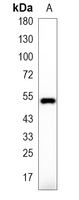 1 - Recombinant Anti-FKBP8 Rabbit mAb AP95284