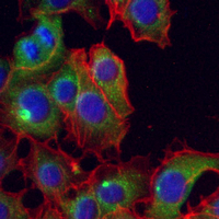 3 - Recombinant Anti-MYO7A Rabbit mAb AP95285