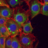 3 - Recombinant Anti-Cytochrome P450 27A1 Rabbit mAb AP95286