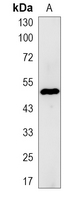 1 - Recombinant Anti-Cytochrome P450 27A1 Rabbit mAb AP95286