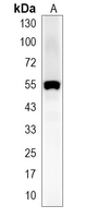 1 - Recombinant Anti-TEL Rabbit mAb AP95287
