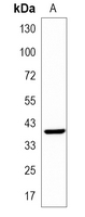1 - Recombinant Anti-M6PR Rabbit mAb AP95290