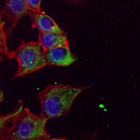 3 - Recombinant Anti-IFNGR1 Rabbit mAb AP95291
