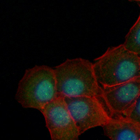 3 - Recombinant Anti-PKC zeta Rabbit mAb AP95292