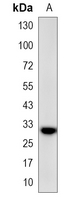 1 - Recombinant Anti-Connexin 32 Rabbit mAb AP95293